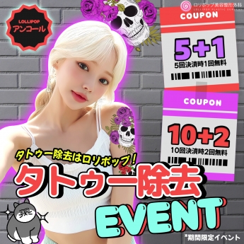 タトゥー除去★Event