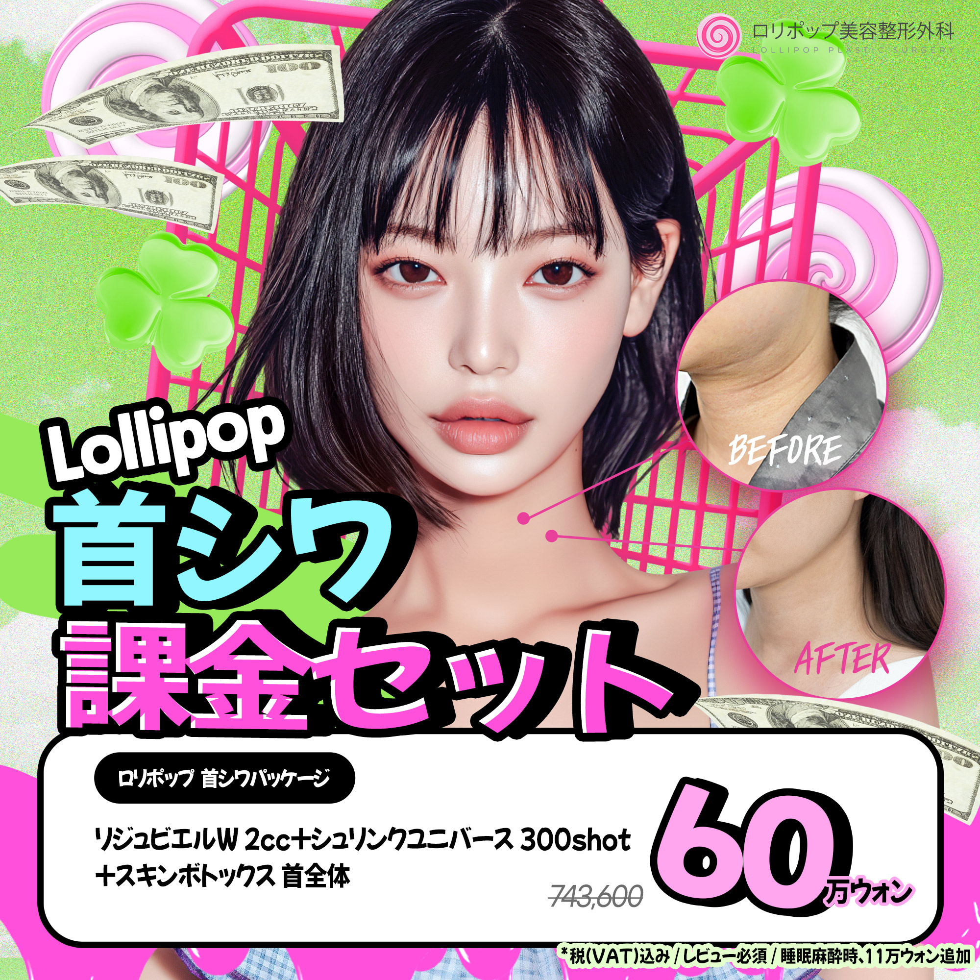 首シワ★課金セット