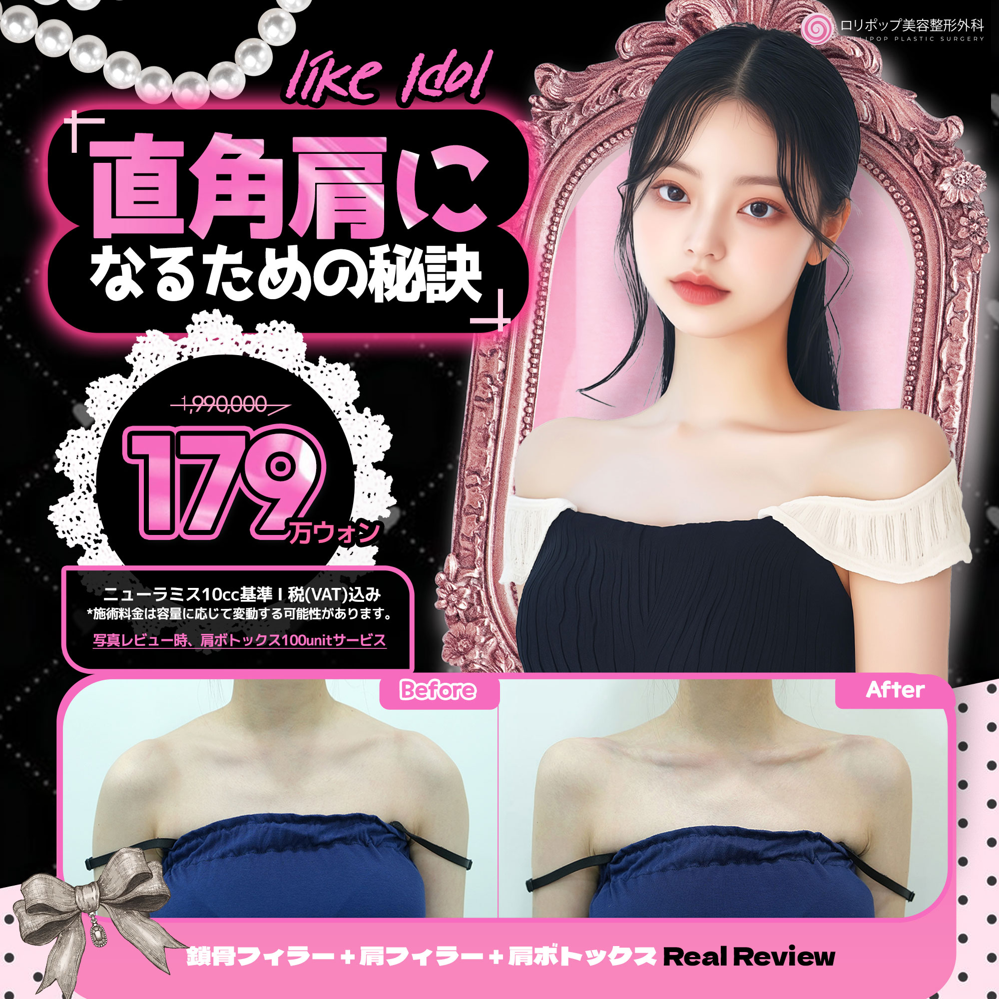 直角肩に なるための秘訣 ♥